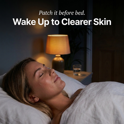 PatchUp — Overnight Acne Patches